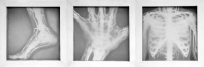 Cut Paper and Led Light by Olivia Hawthorne, Year 12, The Hamilton and Alexandra College Student artwork of an x-ray triptych