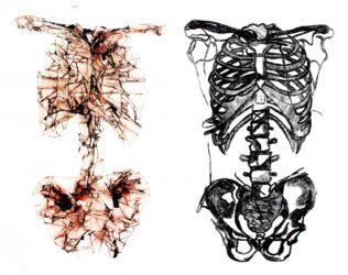 Drypoint etching and monoprint on paper by Natasha Harrison, Year 12, Mentone Grammar Student artworks of a skeleton